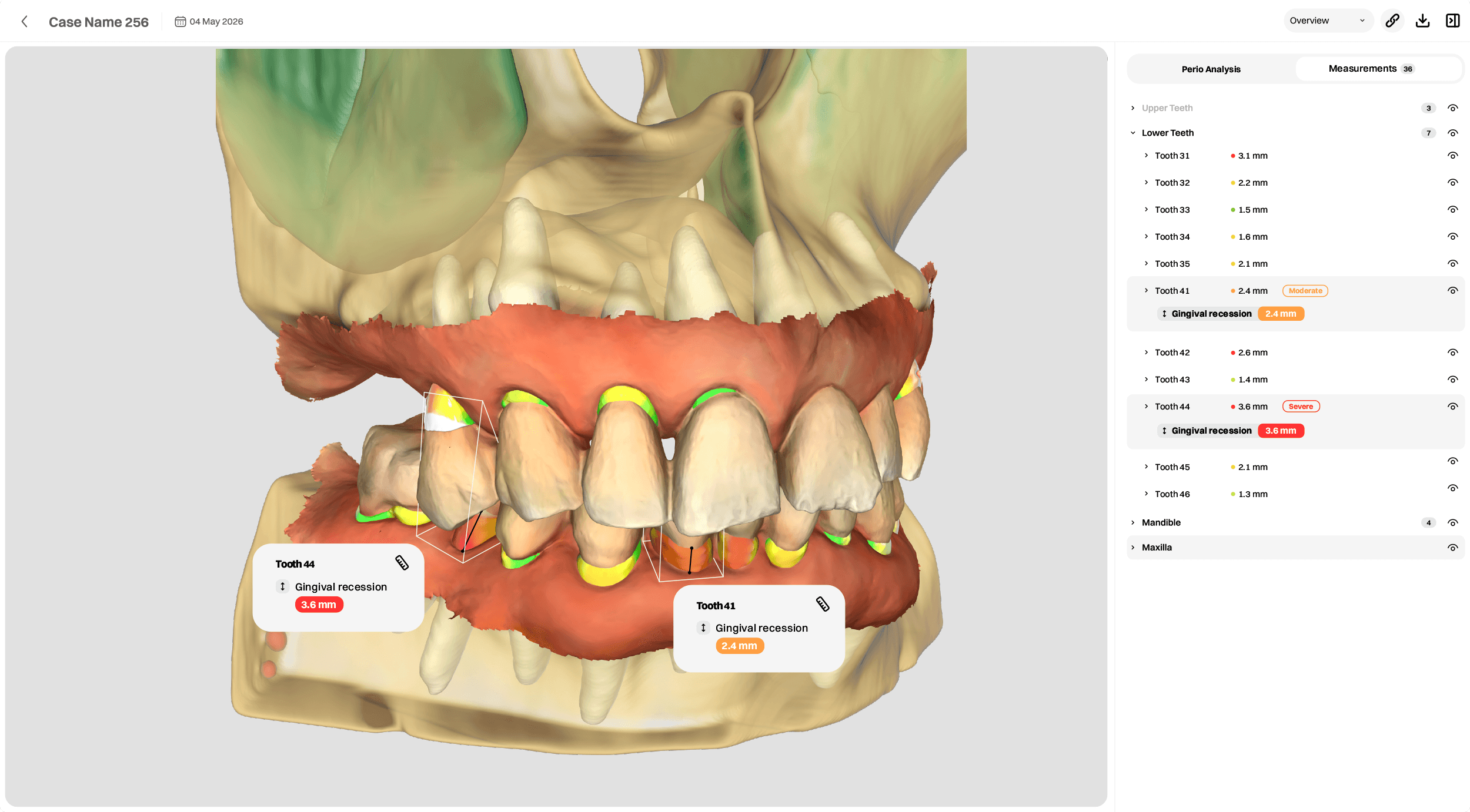 Perio-Detect contactless periodontal analysis viewer