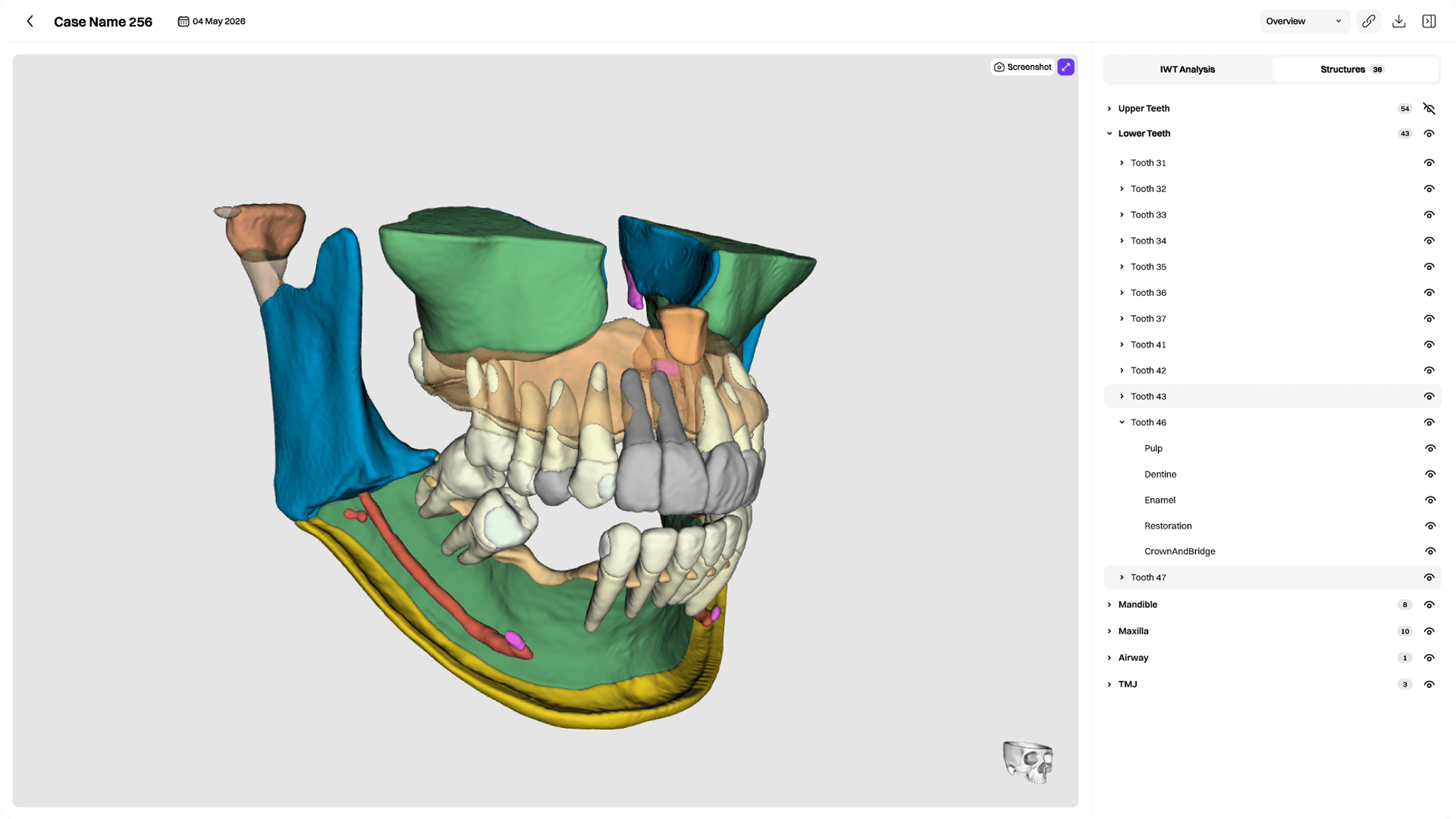 EAI Segment 3D CBCT segmentation viewer