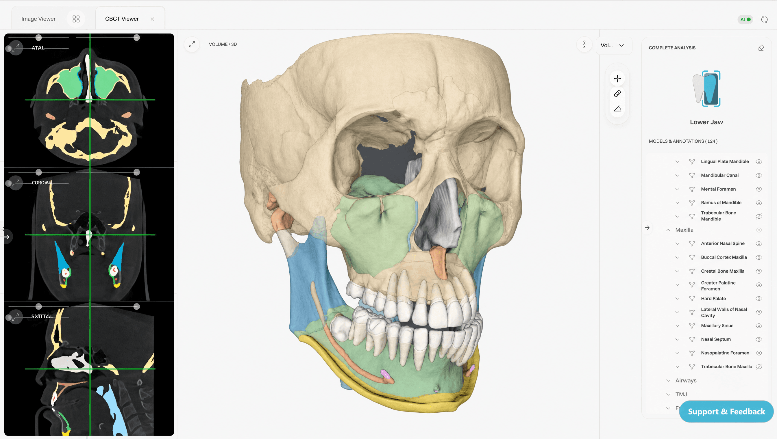 EAI Segment 3D CBCT segmentation viewer