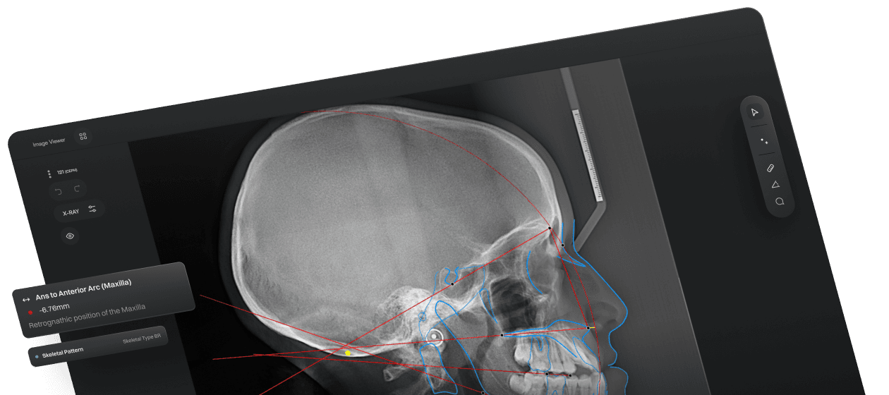 Trace Image